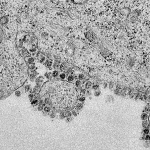 Încă 15 cazuri noi de coronavirus în RM: Bilanțul a ajuns la 109 Încă 15 cazuri noi de coronavirus în RM: Bilanțul a ajuns la 109
